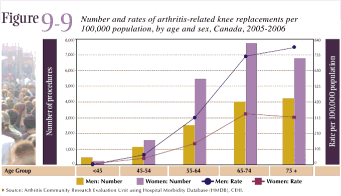 Figure 9-9: Number and rates of arthritis-related knee replacements by age and sex