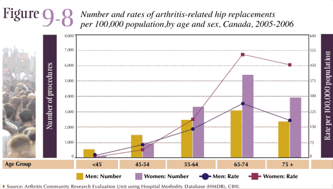 Figure 9-8: Number and rates of arthritis-related hip replacements by age and sex