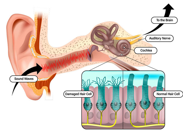 text description is in the next 2 paragraphs