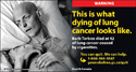 Woman in hospital bed dying of lung cancer.