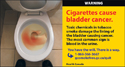 Blood in the toilet due to bladder cancer.