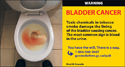 Blood in the toilet due to bladder cancer.