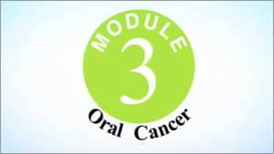 Oral Cancer