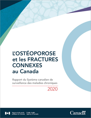 Rapport du Système canadien de surveillance des maladies chroniques : L’ostéoporose et les fractures connexes au Canada, 2020